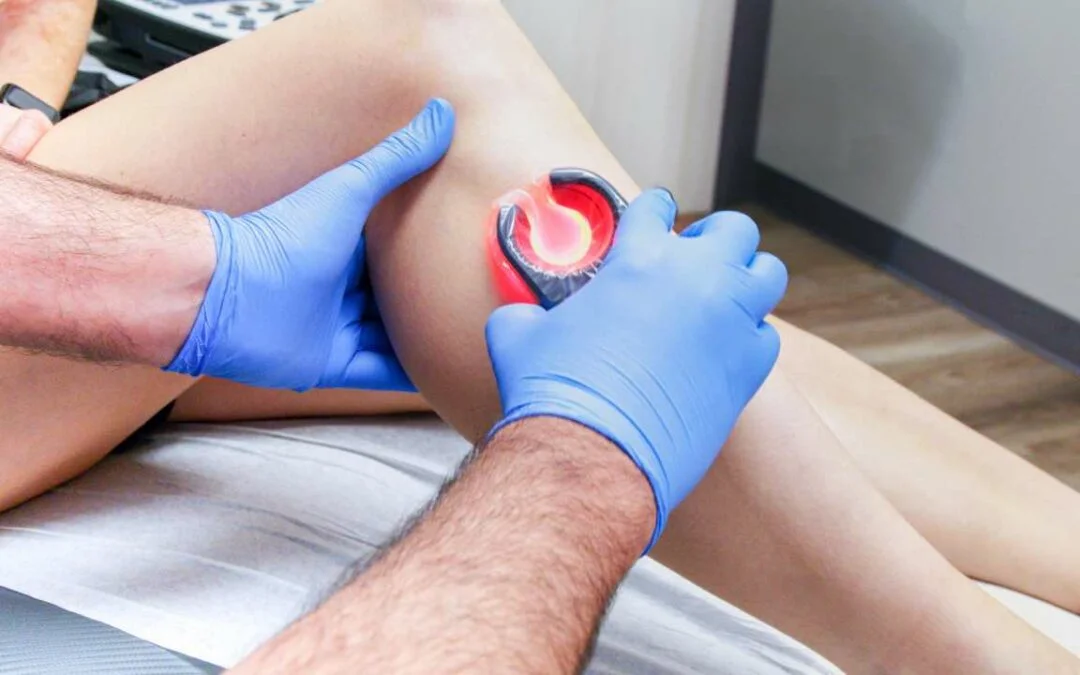 varicose vein treatment New York
